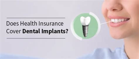 will caresource cover dental implants|How To Get Medical Insurance To Cover Dental Implants